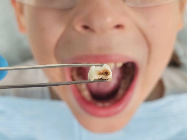 Best Emergency Denture Repair in Wartburg, TN